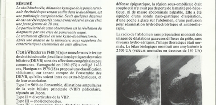 Cholédocèle révélé par une crise pancréatite aigue